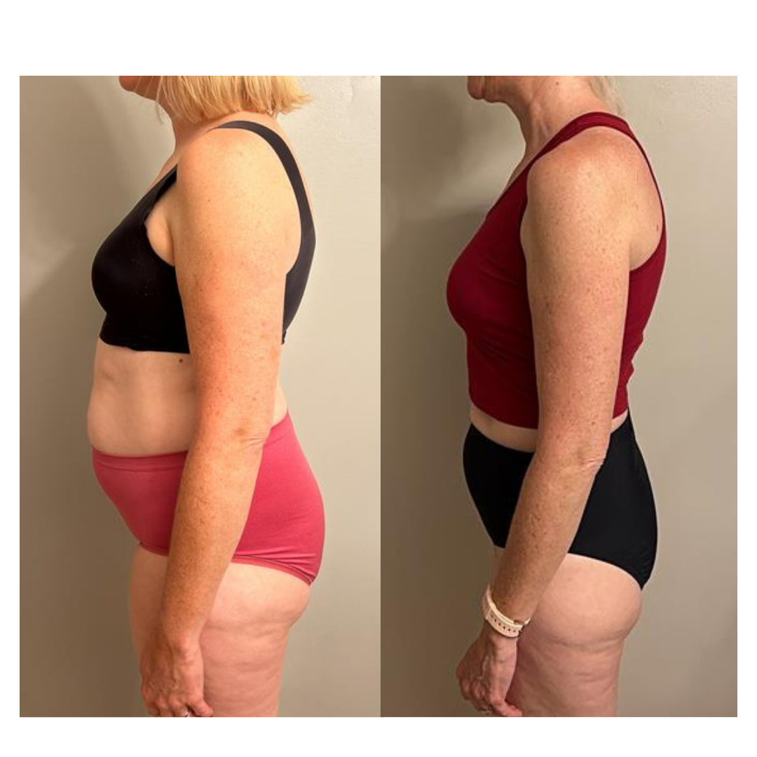 Real client transformation 15